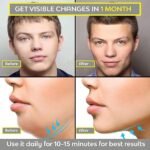 Anubhav Janni Jawline Exerciser Jaw Face and Neck - Define Your Jawline Slim Tone Look Younger Healthier Helps Reduce Stress Craving- Free Rop Hanger For neck Jawline ( pack of 1 ) - Image 6