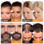 Anubhav Janni 4 G Hair Line Powder Black Hairline Instant Root Touch Up Thickening Fiber Waterproof Concealer For Thinning Hair Balding Gray Coverage Mess Free Women Men (Pack Of 1 Pcs) - Image 8