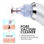 Anubhav Janni Derma Suction 4-in-1 Electric Blackhead Remover Vacuum Pore Cleaner Tool for Men Women Acne Pimple Whitehead Extractor Facial Skin Care Device Nose Face with Adjustable (pack of 1) - Image 6