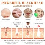 Anubhav Janni 6 in 1 Multi-function Blackhead Remover Tools Electric Derma suction Machine USB Rechargeable Acne Pimple Pore Cleaner Vacuum tool Facial Cleanser Device for Nose (pack of 1) - Image 4