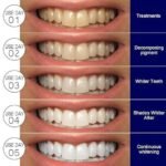 Anubhav Janni Teeth Strip Portable Dental Reduced Sensitivity White Strips Whitener for Removing Smoking Coffee Stain Effective Home Use Tooth Kit Gentle Sensitive Professional (pack of 1) - Image 3