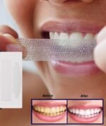 Anubhav Janni Teeth Strip Portable Dental Reduced Sensitivity White Strips Whitener for Removing Smoking Coffee Stain Effective Home Use Tooth Kit Gentle Sensitive Professional (pack of 1) - Image 7