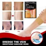 Anubhav Janni Veins Patch Varicose Relief Herbal Anti Swelling Pain Supports Blood Circulation Leg Comfort Patches Dredge Vein Smoothing Reduce Swelling Relieves Pain (12 (PACK OF 1)) - Image 4