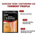Anubhav Janni Veins Patch Varicose Relief Herbal Anti Swelling Pain Supports Blood Circulation Leg Comfort Patches Dredge Vein Smoothing Reduce Swelling Relieves Pain (12 (PACK OF 1)) - Image 8