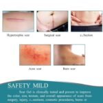 Anubhav Janni Scar Remover Tape Silicone scar tape Scar Removal Sheet Strips For C Section Acne Scars Keloid Surgical Scars Reusable Medical Grade Tape Get Scars Away Painless (Pack Of 1 Pcs) - Image 4